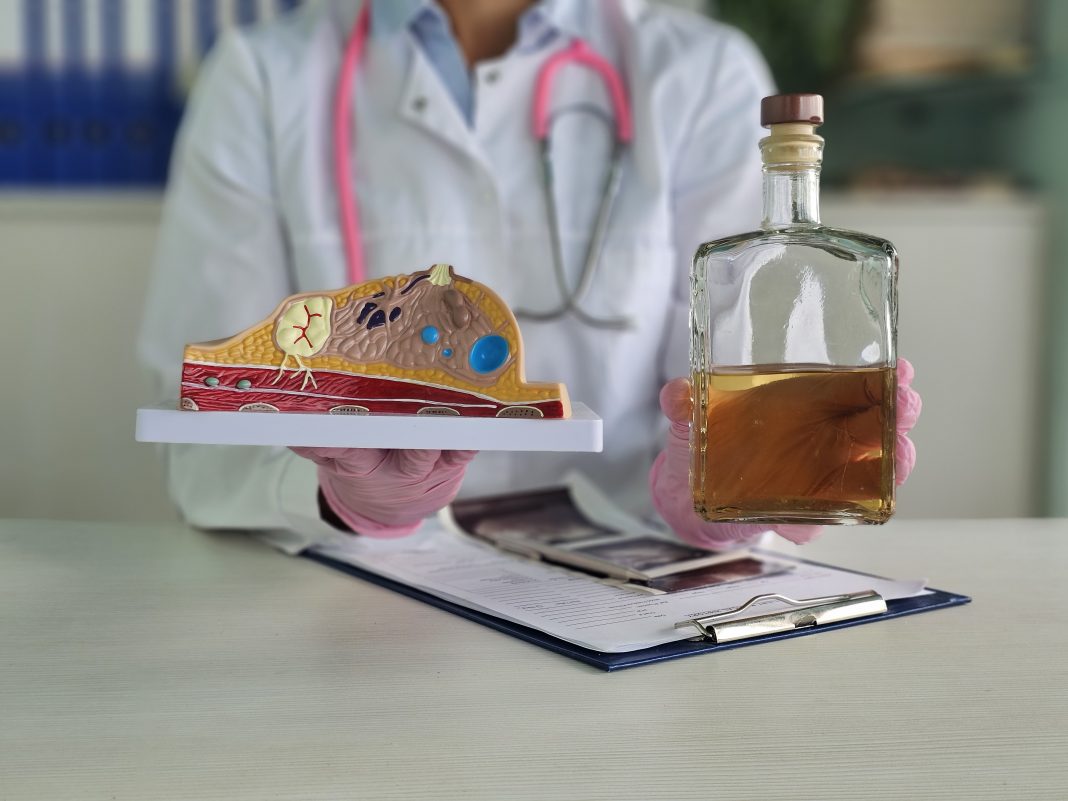 What You Need to Know About Alcohol & Cancer